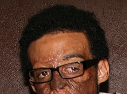 Lead photo